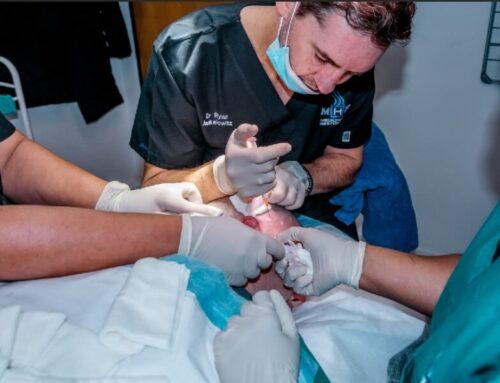 Top tips for hair transplant surgery